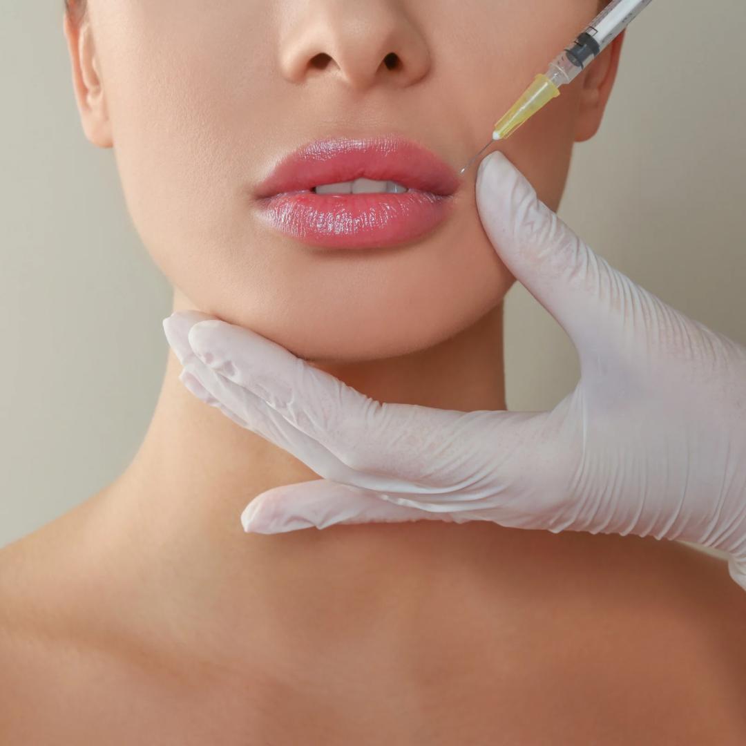 filler-des-levres-pour-les-harmoniser-avant-le-mariage