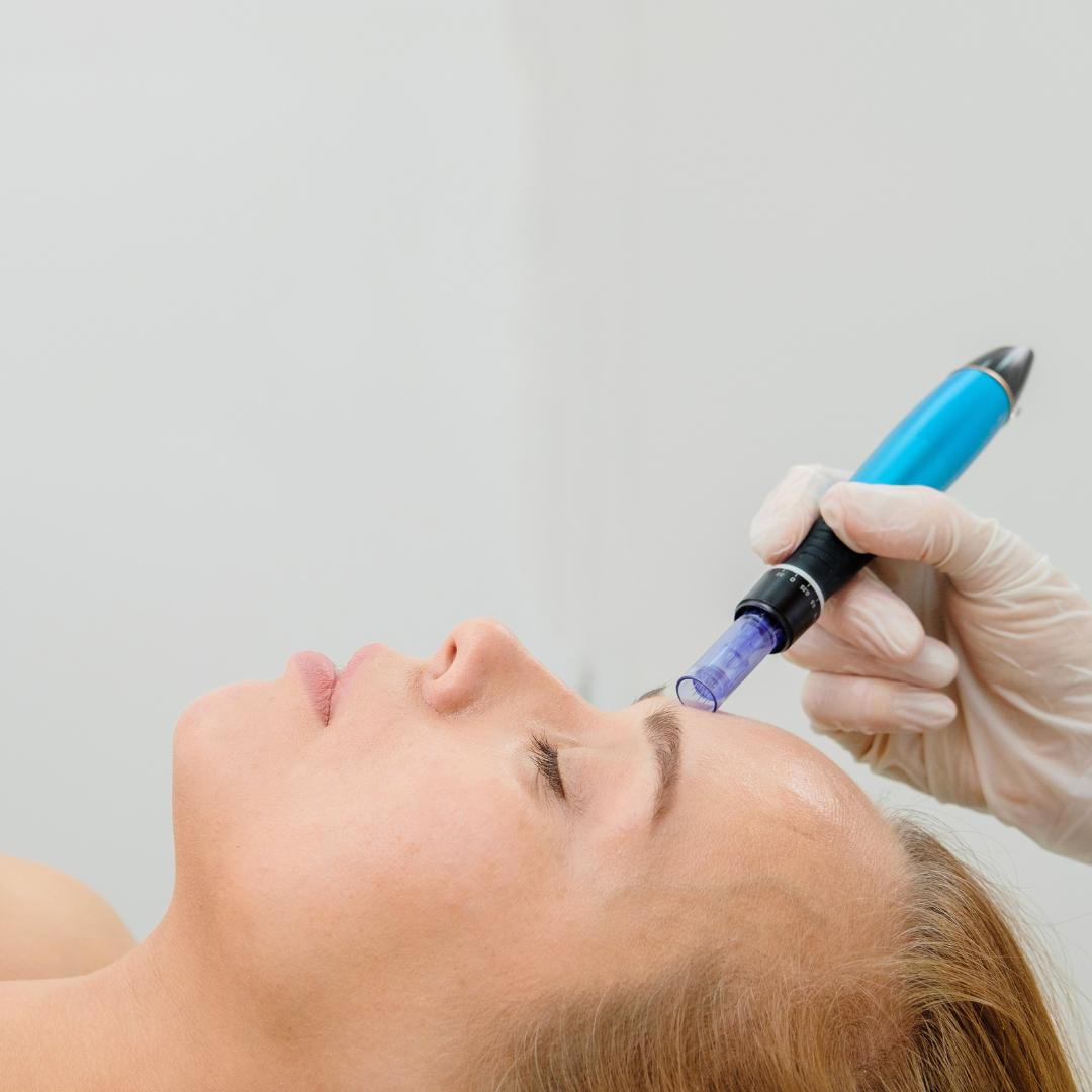 mesotherapie-visage