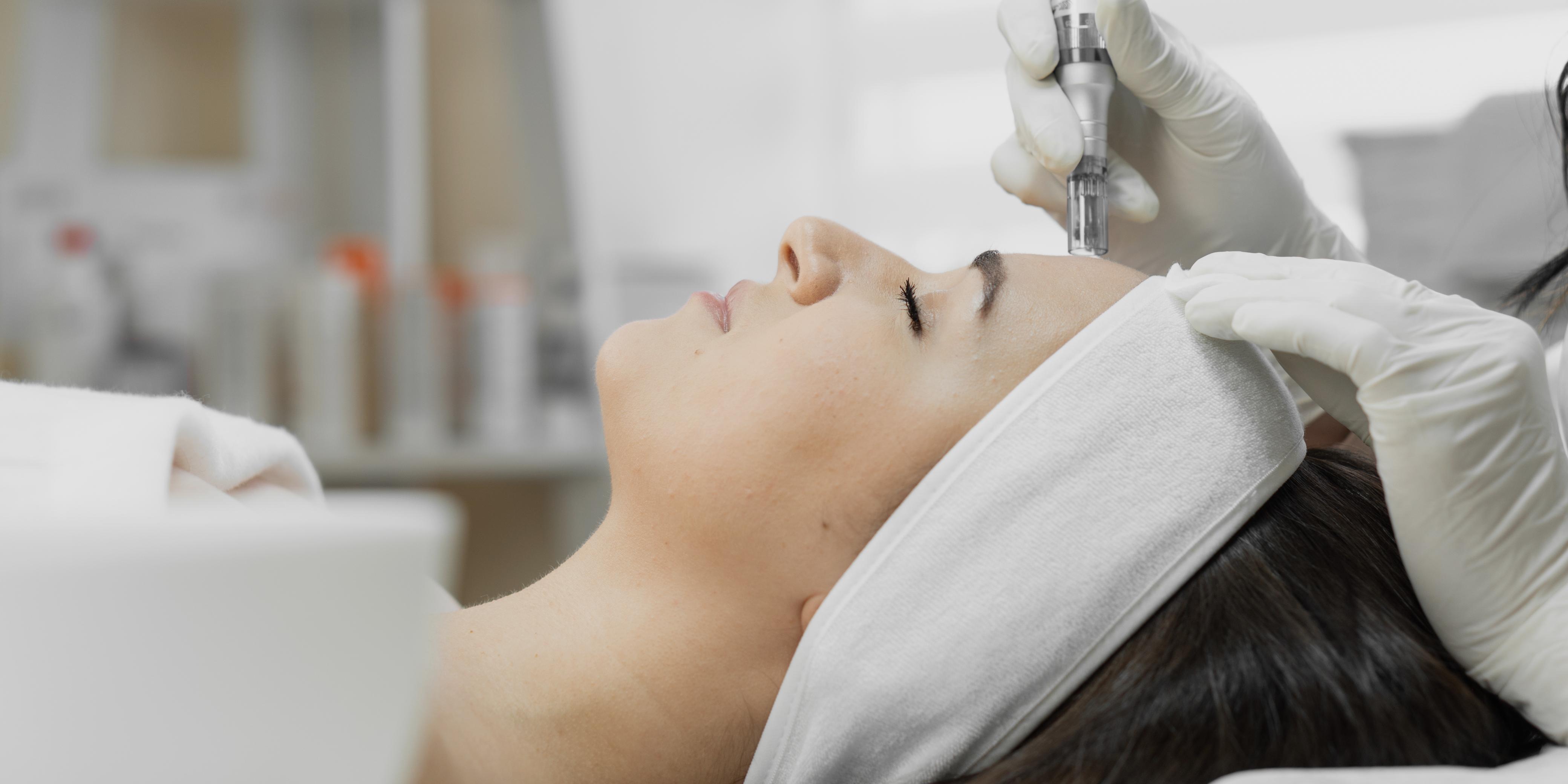 mésothérapie-visage-pour-cicatrices-acnés-solution-permanente